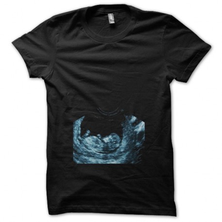 Shirt echographie femme enceinte noir pour homme et femme